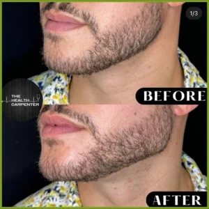 Before and After Treatment Images | The Health Carpenter in Orlando, FL