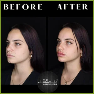 Before and After Images in Orlando, FL | The Health Carpenter