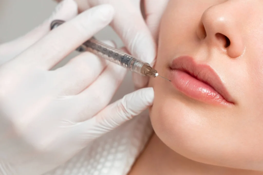 Juvederm® Fillers by The Health Carpenter in Orlando, FL