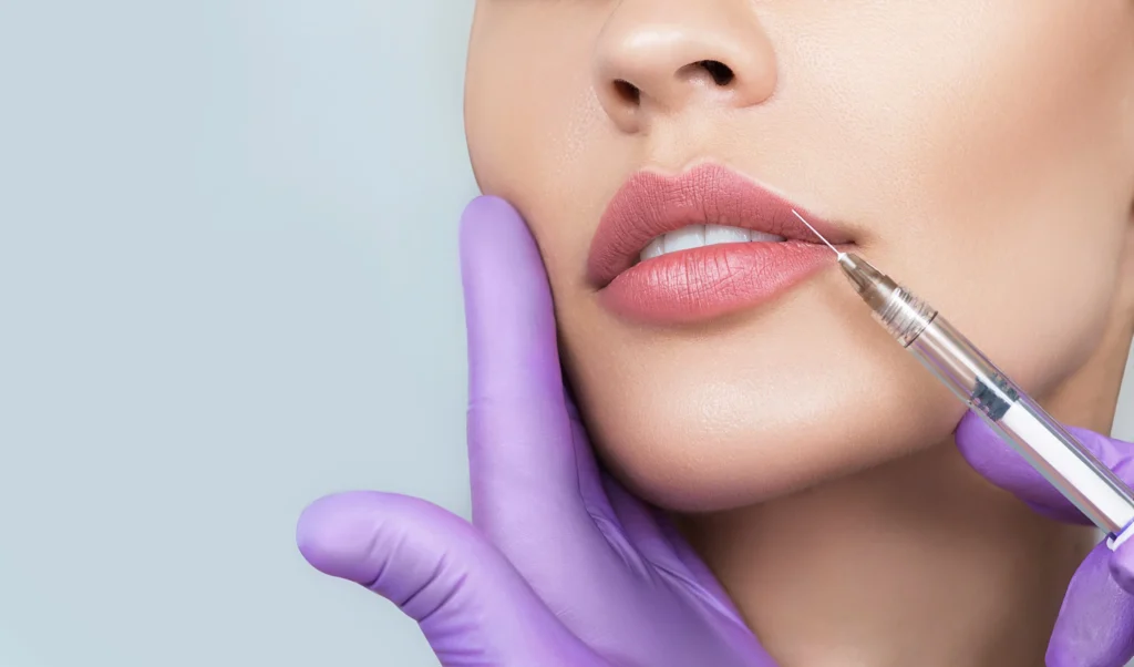 Revanesse Fillers by The Health Carpenter in Orlando, FL