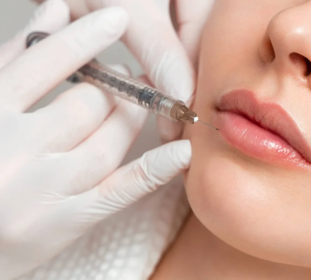 Juvederm® Fillers by The Health Carpenter in Orlando, FL