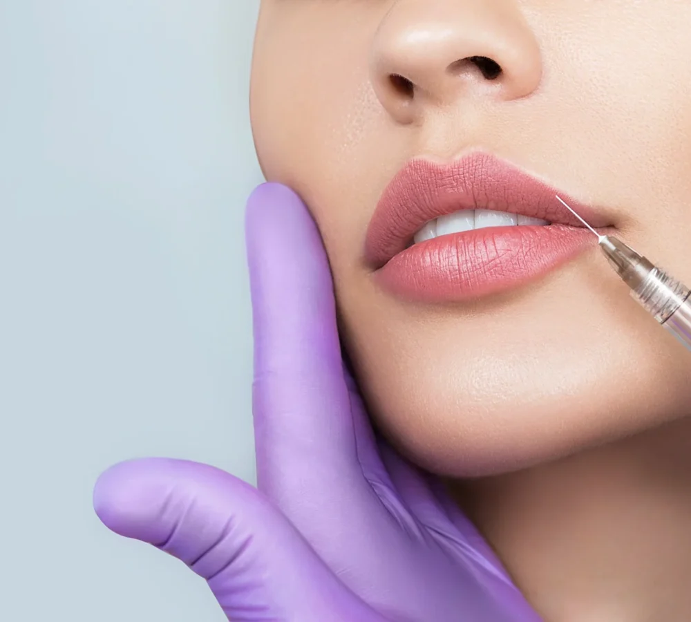 Revanesse Fillers by The Health Carpenter in Orlando, FL
