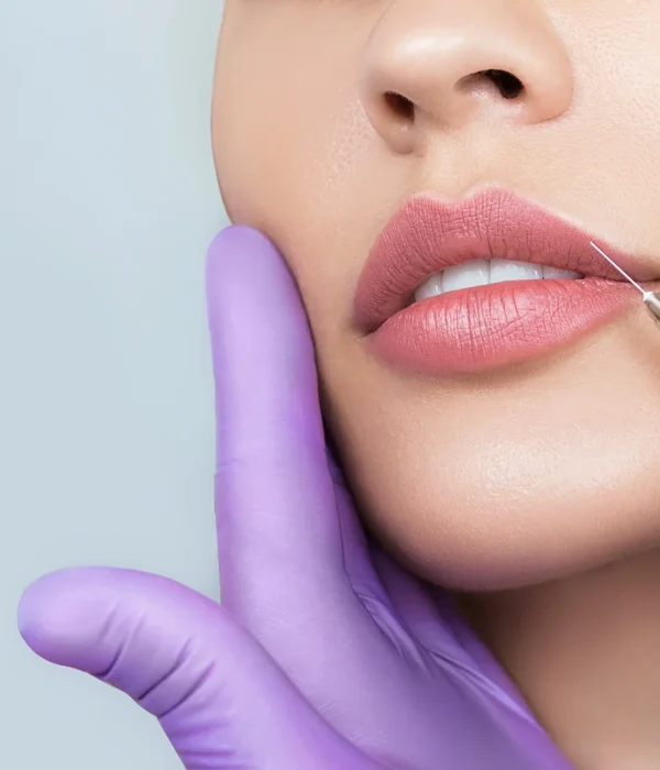 Revanesse Fillers by The Health Carpenter in Orlando, FL